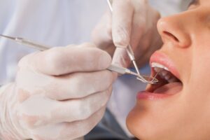 operazioni del dentista